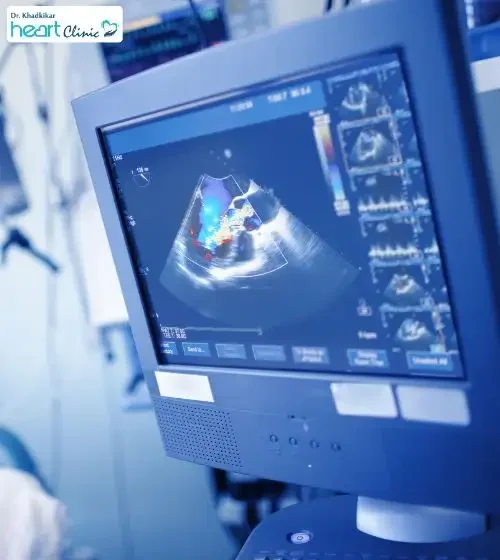 2D Echo test in Pune - Know the benefits from cardiologist - Dr. Gajanan Khadkikar