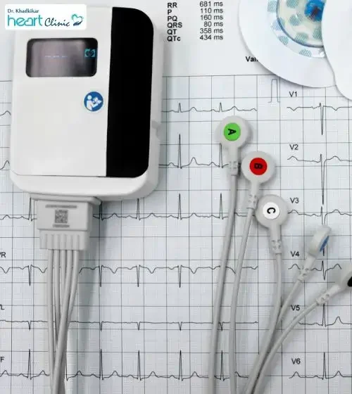 ECG Test in Pune – at Dr. Khadkikar Heart Clinic, Moshi ECG Test in Pune - at Dr. Khadkikar Heart Clinic, Moshi