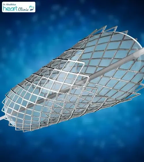 Cost of Angioplasty in Pune Cost of Angioplasty in Pune